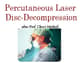 Slider image (8) Dr. GIAN PAOLO TASSI | Neurosurgery Specialist